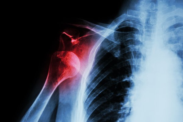 Able Orthopedic (@AbleOrthopedic) / Posts / X