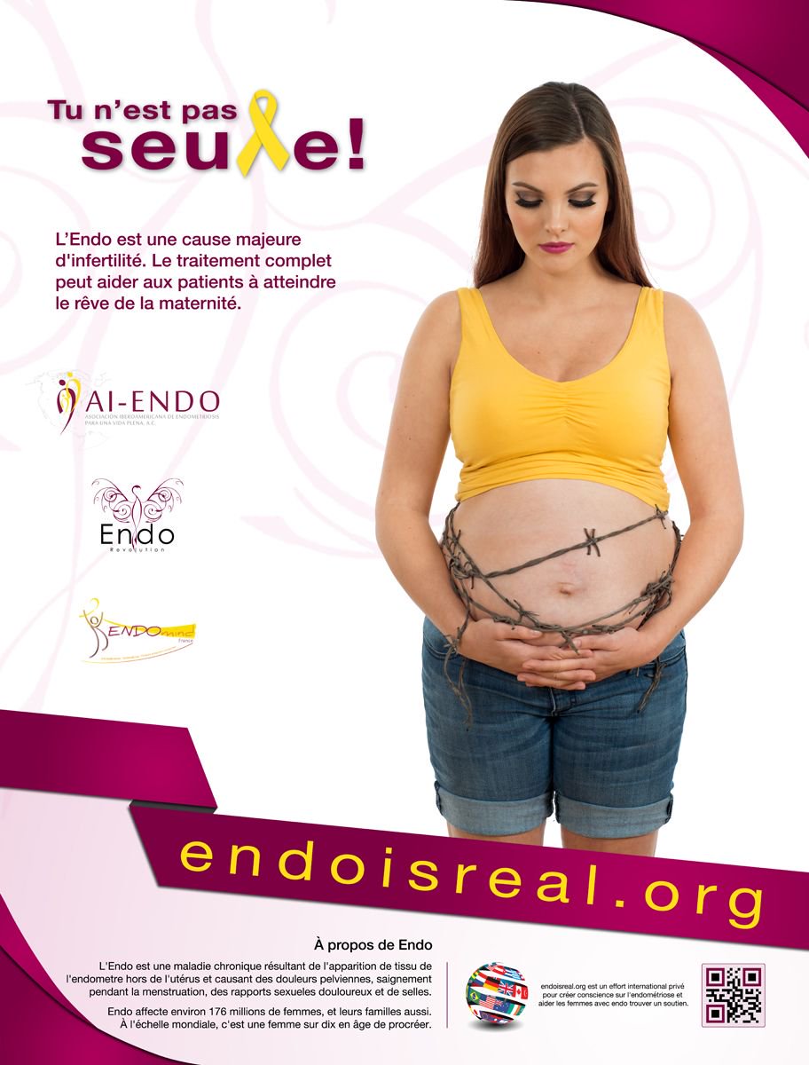 endoisreal's tweet photo. L’Endo est une cause majeure d'infertilité. Le traitement complet peut aider aux patients à atteindre le rêve de la maternité. #endoisreal https://t.co/58d4MLao3L