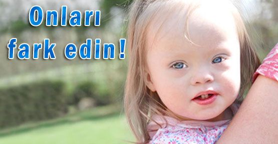 bayan98521073's tweet photo. #DownSendromu beklentilerinizi bir tarafa bırakın bana normal davranın ben herşeyi anlıyorum sadece kendimi ifade edemiyorum https://t.co/emaEnslB4j