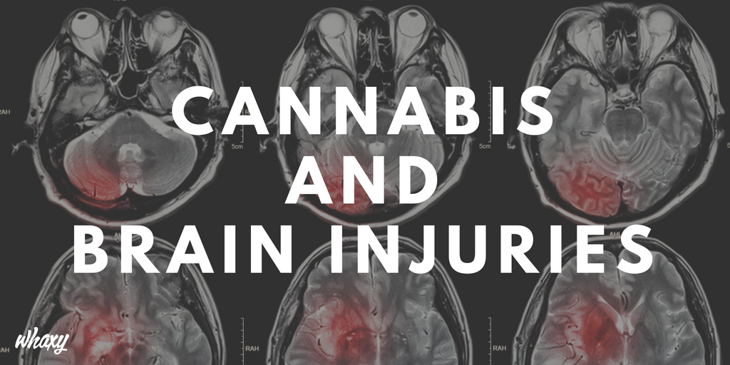 ThinkTankExile's tweet photo. Research Suggests #Cannabis May Be Able To Save Brain Injured Patients https://t.co/ev1GIaadXZ https://t.co/askELntjEx