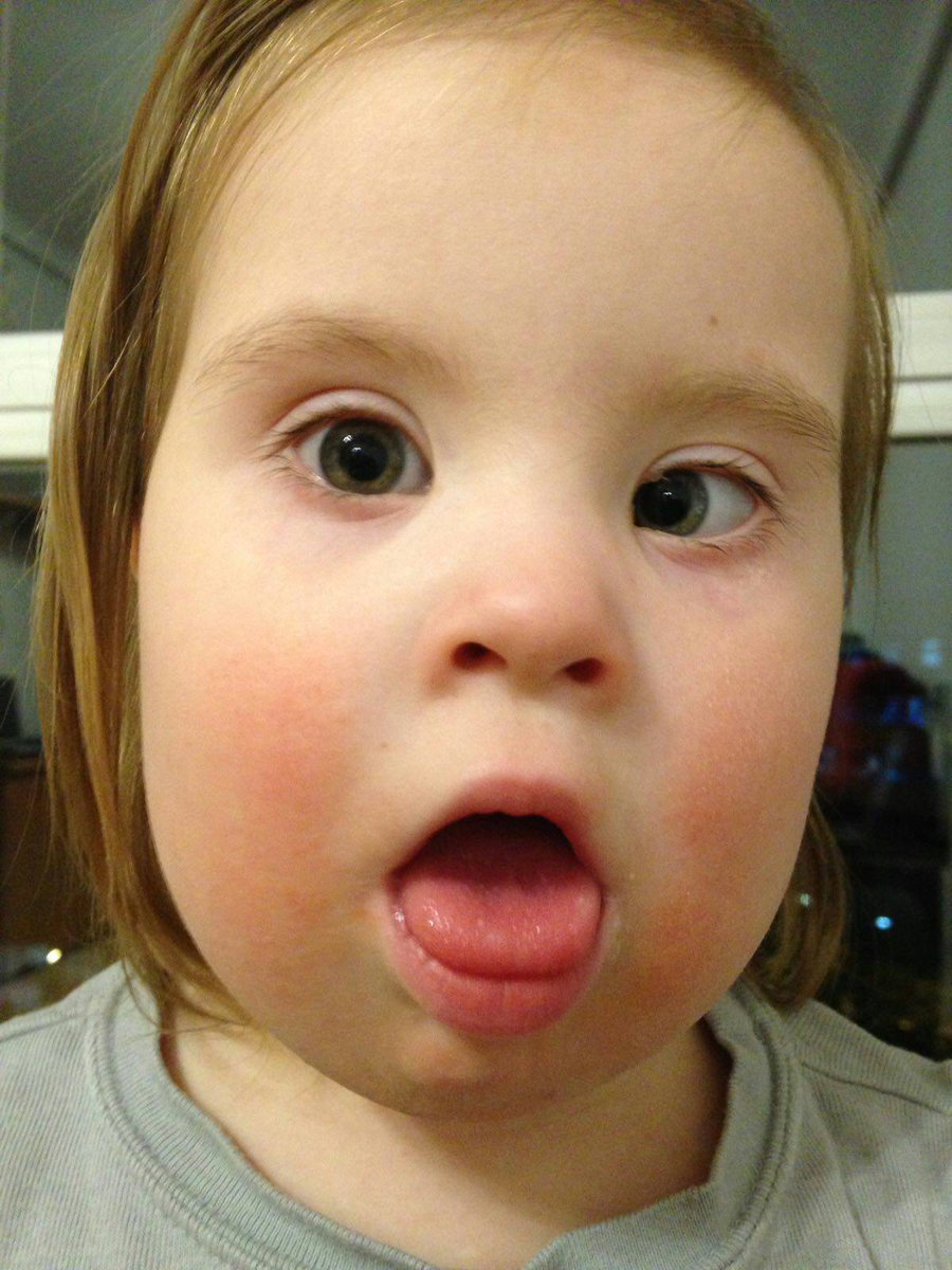 Rhology's tweet image. Mija da gozo a todos. La industría medical dice que habría sido mejor abortar. Hay que arrepentirnos.
#SindromeDeDown
#AbolirElAbortoHumano