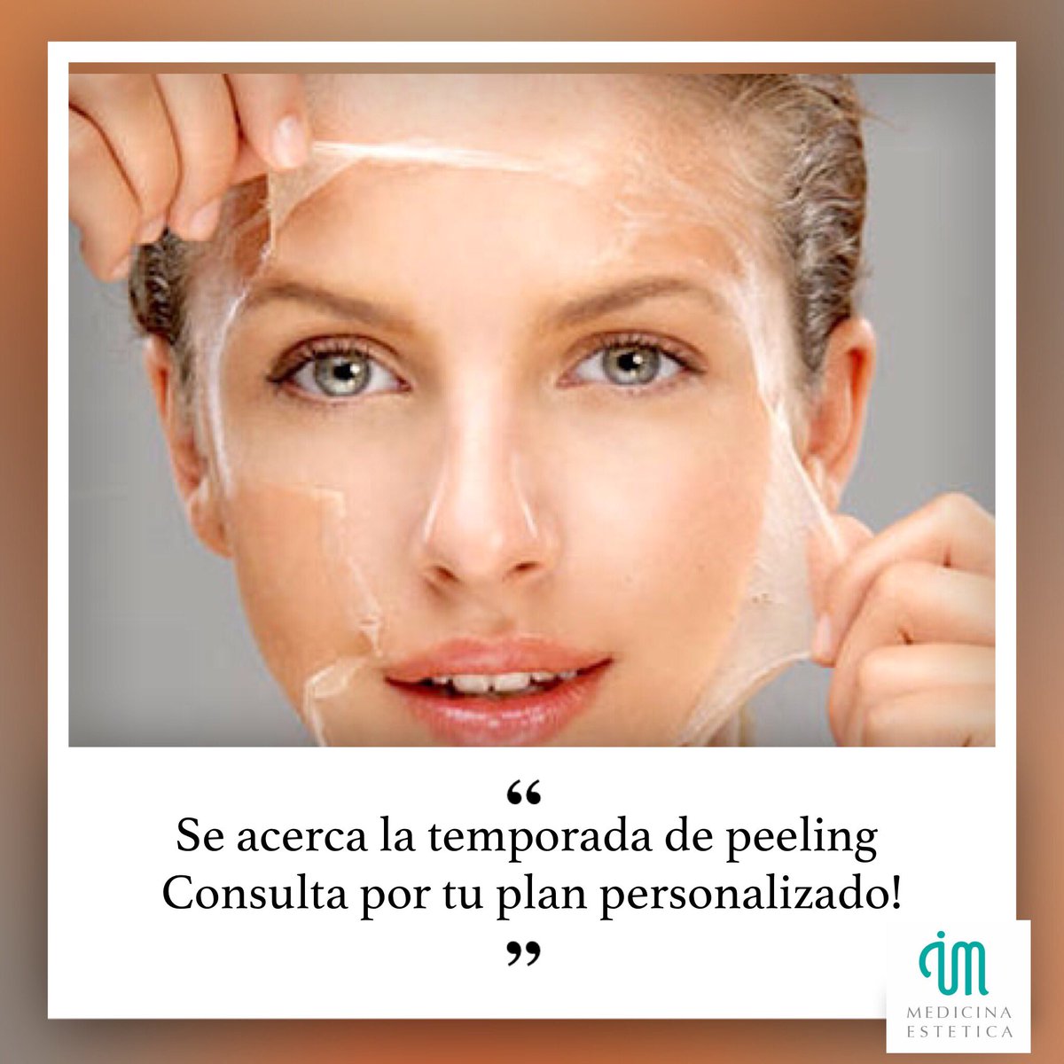 ImMedicina's tweet photo. #Peeling Elimina manchas y sus secuelas , poros dilatados, acné, signos de envejecimiento prematuro, lineas de expresion y arrugas finas. https://t.co/l6Gv4fqaMO