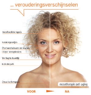 kans etnisch Koning Lear HILDE VAN PEER Beautyconsult on Twitter: "Een jeugdigere uitstraling en jongere  huid met mesotherapie! https://t.co/IVvQyc5bsS #antiaging #antirimpel  #eeuwigjong https://t.co/tQyHrFWhIz" / Twitter