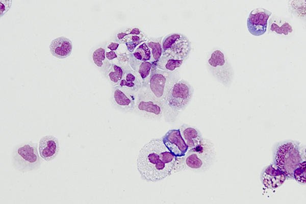 harvardstemcell's tweet photo. Researchers use #stemcells to advance research on rare blood disorder. https://t.co/TnJ9y1GLwT
