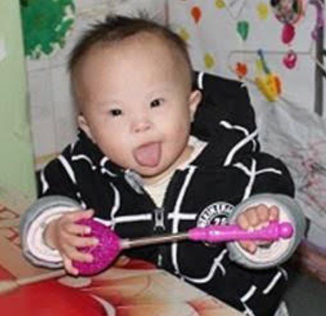 ReecesRainbow's tweet photo. Baby #Meilani is a #healthy girl with great overall development. https://t.co/I8X14jjzkF #wdsd #worlddownsyndromeday17 https://t.co/qw4qd7ztBK