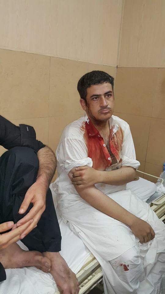 _dawoodkhan's tweet photo. It is not the first time of #IJT students brutality with peaceful pakhtoon students
#GirlsUnderAttackInPU https://t.co/XyuHYUj766