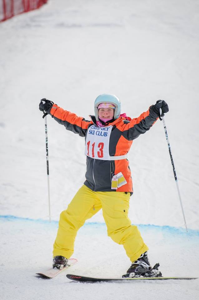SpecialOCalgary's tweet photo. Our @SpecialOlympics athletes w/ Down Syndrome enrich the lives of our volunteers, athletes and community every day! #WorldDownSyndromeDay https://t.co/Ta2BsxglIT