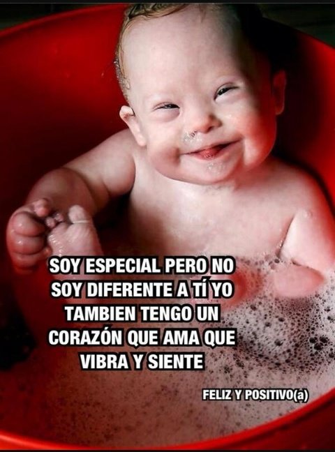 Arantxa2109's tweet photo. Todos somos especiales 💕 #SindromeDeDown #daleallike @vistetumente https://t.co/1BGeg0ndTg