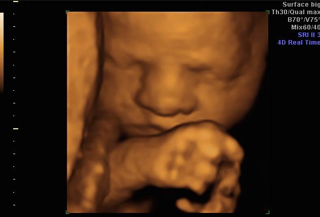 WttWSurrey's tweet photo. 🌟💜👶A Gorgeous Face Captured Over the Weekend👶💜🌟 #baby #4dbaby #4dscan #4dbabyscan #4dultrasound #4dface #pregnant #pregnancy #scanpicture https://t.co/E6P5mmTMhJ