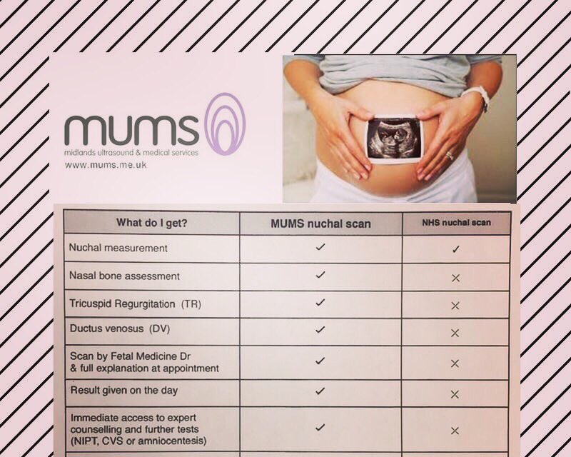 mums_care's tweet photo. Your nuchal scan at MUMS #pregnancy #nuchalscan #downsscreening #antenatalscreening #solihull #babybump https://t.co/wp75nFe3Tb