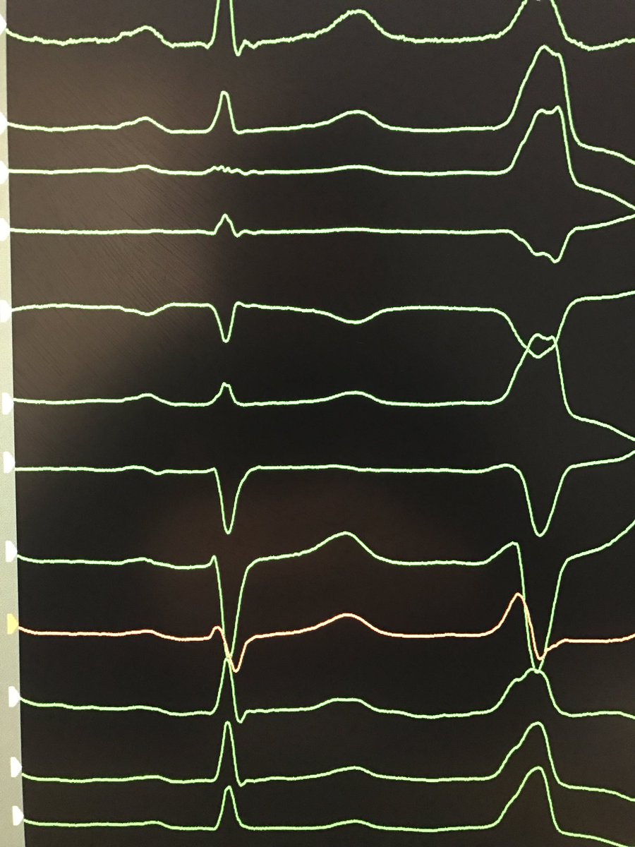 atypicalflutter's tweet image. Where in RVOT ? @aalahmadmd @SoufianAlMaha @rdschaller