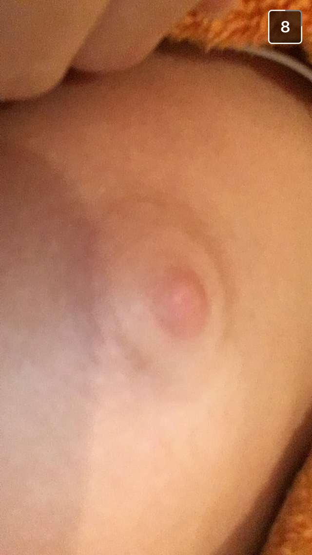 ptitponey46's tweet photo. #nudes #snapchatte #boobs https://t.co/elKvlzTSKm