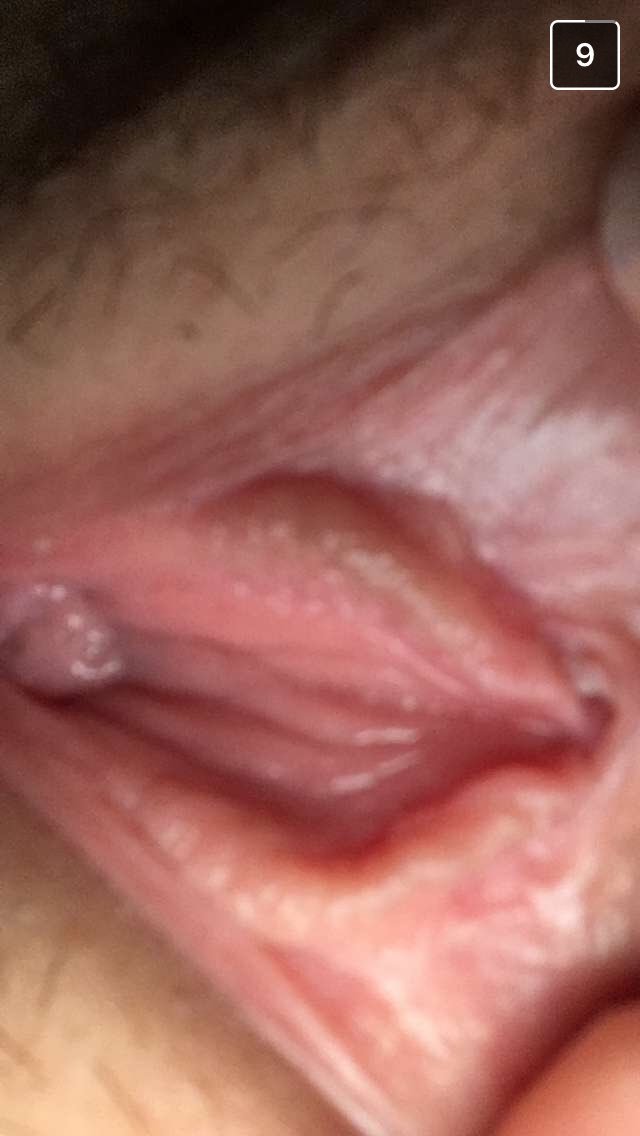 ptitponey46's tweet photo. #nudes #snapchatte #boobs https://t.co/elKvlzTSKm
