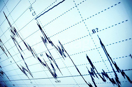 Zoomtrader_EN's tweet photo. With our help you can get a possible return of 83% on every winning trade! #trade #stocks #binaryoptions #zoomtrader https://t.co/Lx8w2kaEDL