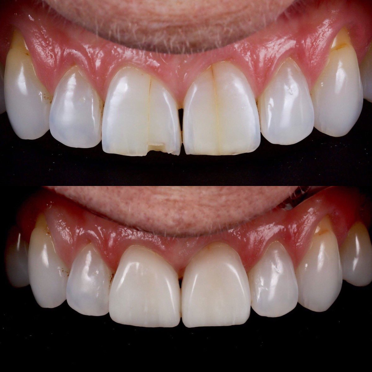 Phil Jones - Kulzer tweet media