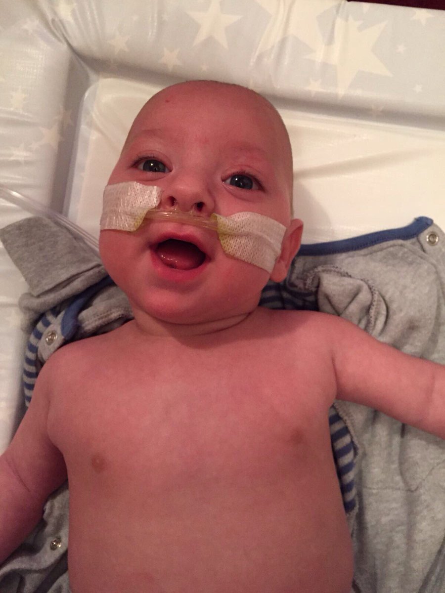 ssowney's tweet photo. Someone loves peas! Stained his dressings 🙈😂#prematurebaby #babyonoxygen #weaningearly #happybaby #preemie #25weeker https://t.co/AY0vU72zTB