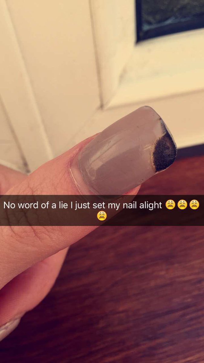 sabrinamunnx's tweet photo. My poor thumb https://t.co/bjnvwcGD8R