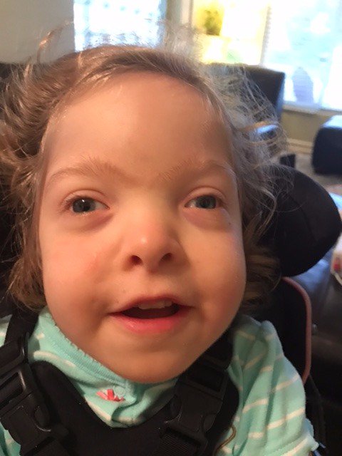 carriehun's tweet photo. My daughter is my inspiration. She has Bohring-Opitz Syndrome. Learn more at the @bohring_opitz Foundation booth tonight! #ACMGMtg17 https://t.co/HGmEuJZYSW