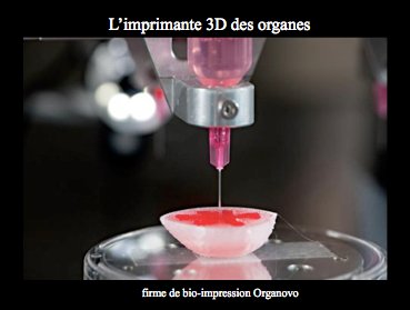 Mariechamorin1's tweet photo. Organovo, les mecs qui veulent imprimer un foie humain.
#3DprintingMadness #ps291 https://t.co/fwe4pOyNzv