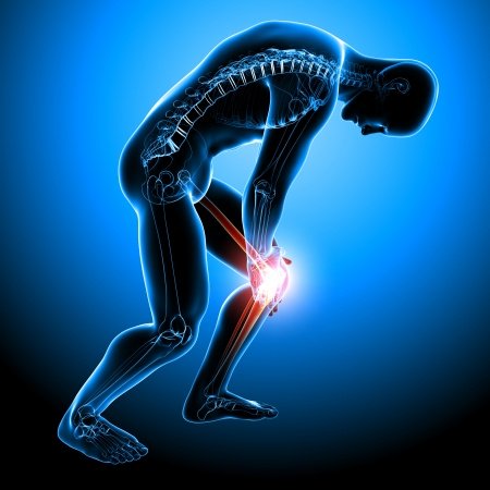 naturogain's tweet photo. Arthritis Pain Herbal Treatment
#Arthritis #JointPain #JointStiffness #JointInflammation #JointSwelling #Herbal
https://t.co/owCLF4dNNS https://t.co/q3lsRER8EY