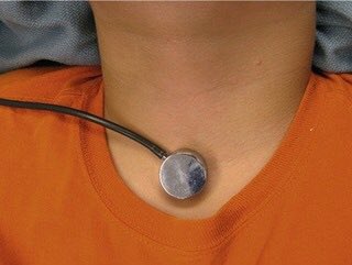 PedsAnesNet's tweet photo. From the forum archives: Precordial Stethoscopes https://t.co/sB0536ICgB #pedsanes #AnesEd https://t.co/ozpXgixVfI