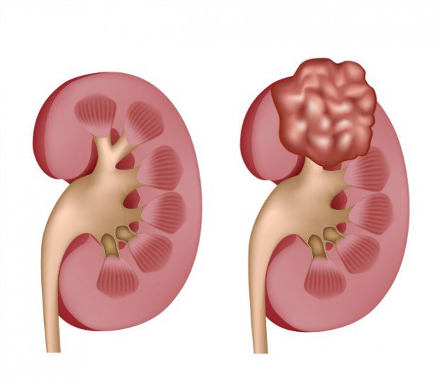 noticaldas's tweet photo. Requiere extracción renal urgente y la EPS lo aplaza https://t.co/MzKfYLK9NX https://t.co/m6NZB7RsFr desde todamanizales