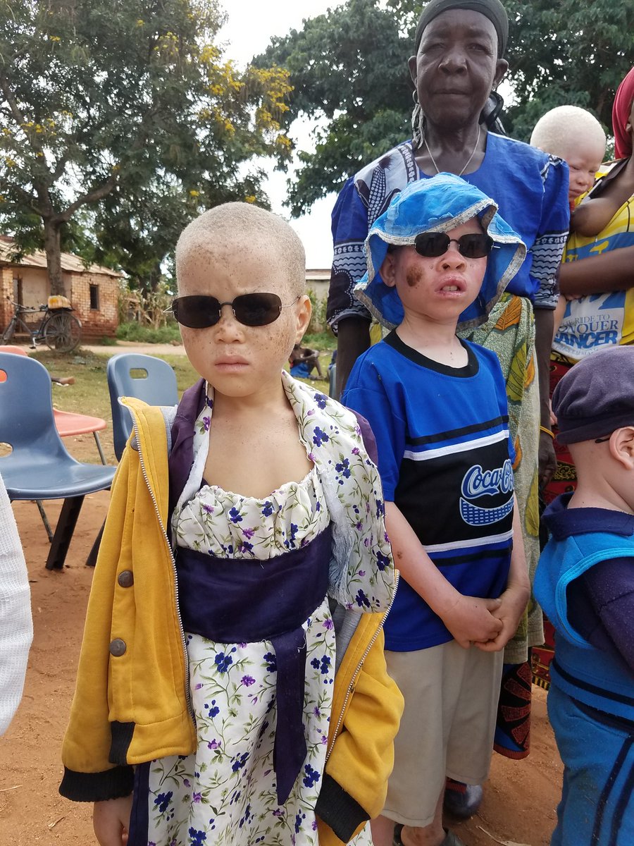 HabibaRezwana's tweet photo. Don't discriminate against us. # protect me. Am also human @TiunikeOnline @cherrynicely @fawziaosman @AlbinismAfrica @Albinism https://t.co/kVN99MACZU