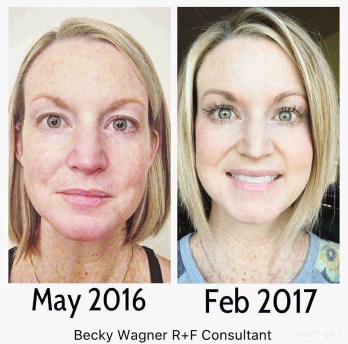 JudiePalmisano's tweet photo. Want these results?  I love sharing products that make people feel more confident! #redefine #reverse #lashboost https://t.co/jcEuyapohm https://t.co/tnr4VewaG0
