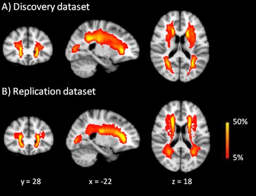 human brain mapping 2017 human brain mapping 2017
