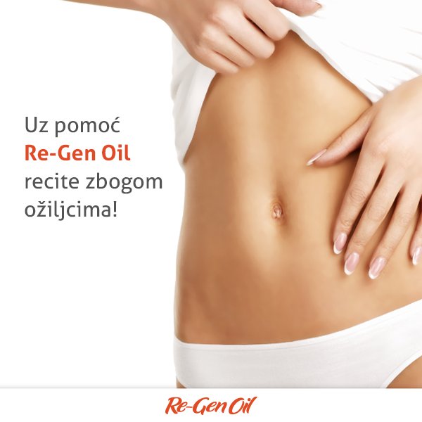 ReGenSrbija's tweet photo. Nanesite Re-Gen Oil na stare i nove ožiljke i poboljšajte izgled kože. https://t.co/T26Zv7kCVY