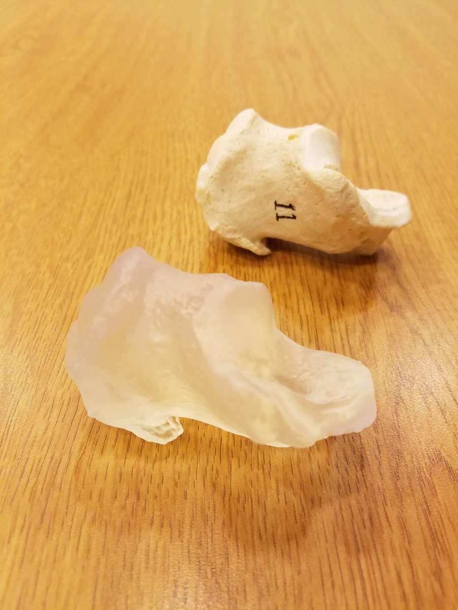 anthrobones's tweet image. #Human calcaneus, #3dscan using #NextEngine #scanner, printed on #Formlab #Form2 #3dprinter. Great print! #3dprinter #3dprint #anatomy