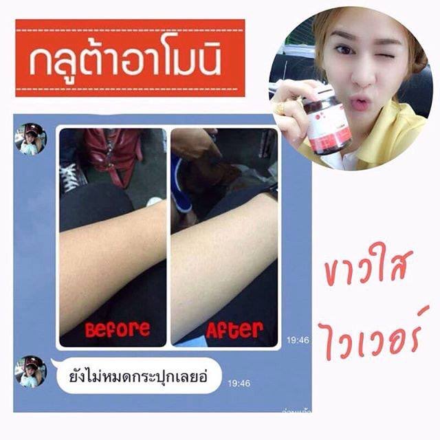 👉🏻ขาวด่วน ขาวไว ขาวอมชมพู
✅ถูกที่สุด
✅เห็นผลที่สุด
✅รีวิวเยอะที่สุด
✅ขาวแล้วไม่กลับมาดำ
👍🏻เพียงกระปุกละ 290.-
ทักไลน์ไอดี @bib4873c (มี@)