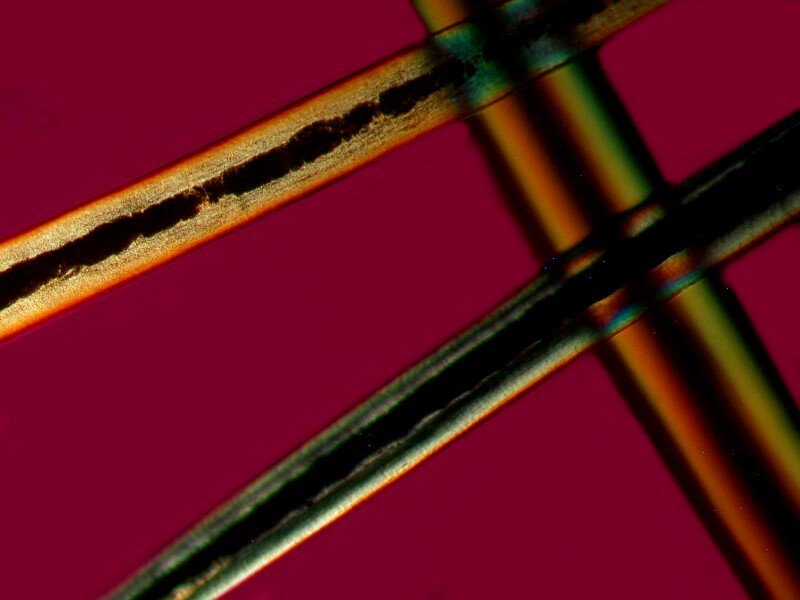 ISHRS's tweet photo. #FollicleFridays: On average, 25 meters of hair fiber is produced on the adult scalp every day. https://t.co/7iWG8VSDzS
