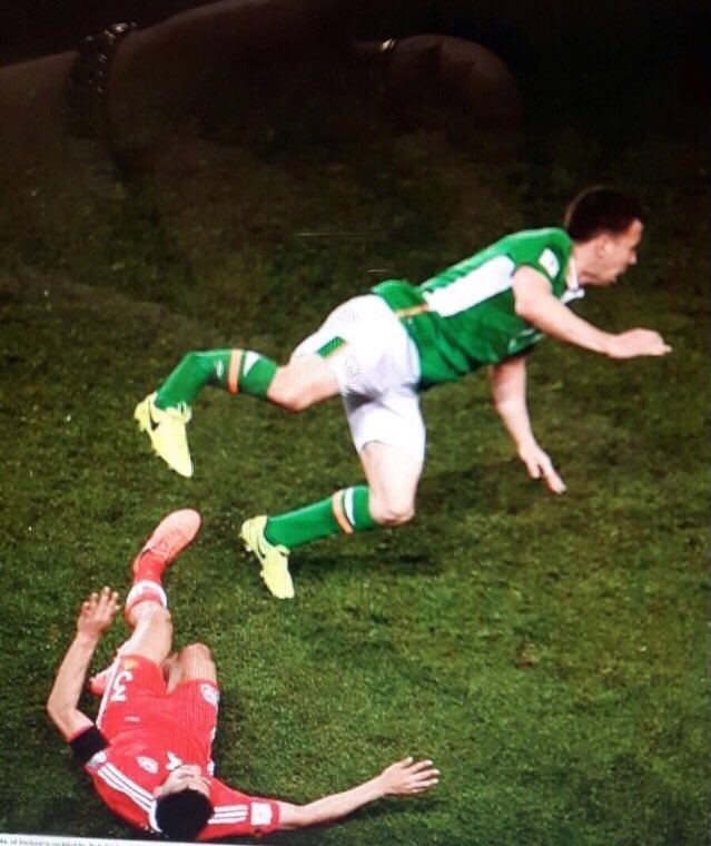 OfficiallyFoot's tweet photo. GRAPHIC CONTENT:

Seamus Coleman horrendous injury https://t.co/CMuoiKhzLX