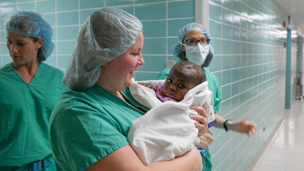 BlueLineMed's tweet image. Risky operation removes parasitic twin from baby - BBC News crwd.fr/2mz0dhR