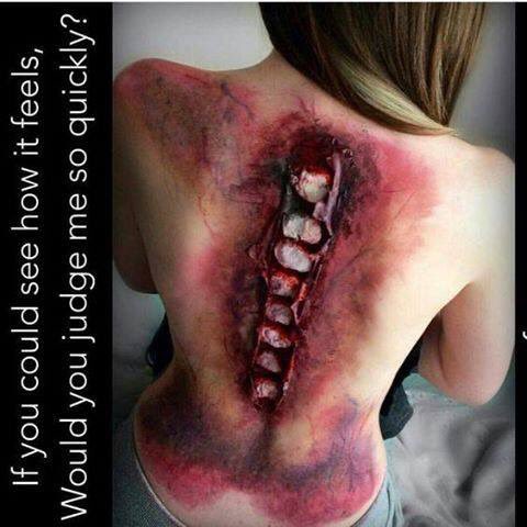 Frannibal77's tweet photo. #Fibromyalgia #fibrowarrior #fibrosucks https://t.co/RSu4icKPb4