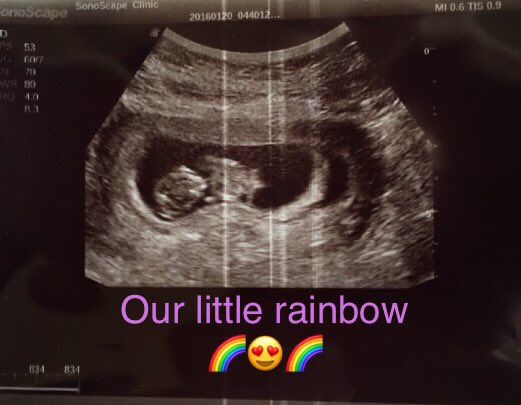 mj_ATCshow's tweet photo. #fisherfamilyrainbow #10weekspregnant #gettingbigger #strongheartbeat #squirmy #wiggly #startingtofeelbetter #coldH2O #freshjuicyfruit https://t.co/Lo0f1f8LXM