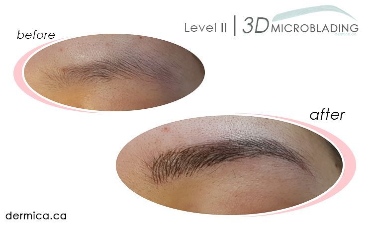 dermica4ME's tweet photo. Book your 3D Microblading session today at dermica.ca
Results last up to 3 years 😍
#microblading #browexperts ##3dbrows #etchedbrows #yeg https://t.co/TUSmjyJPEI