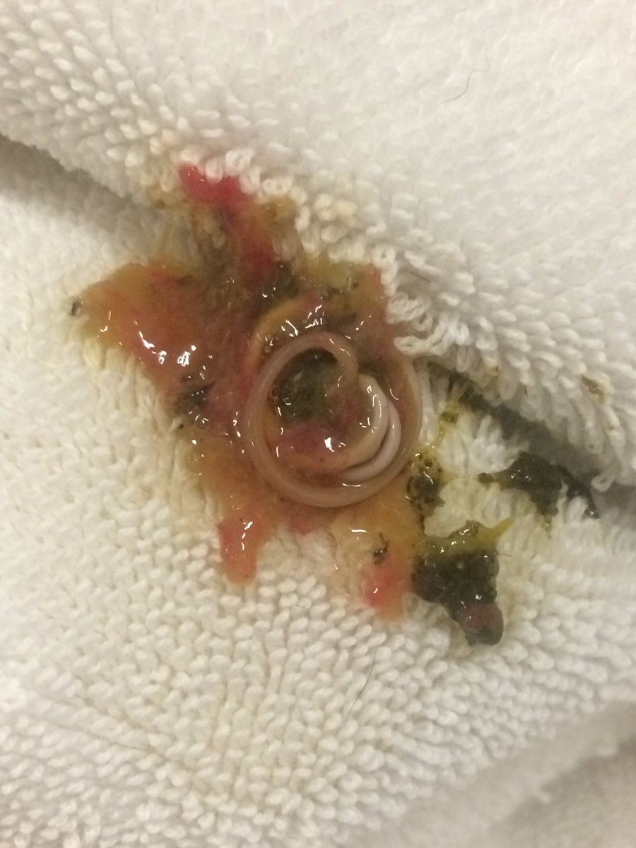 NevHosty's tweet photo. Guess what these beauties are?!! They're round worms and yes we can get them in our bodies! #VaccinateYourAnimals #UsePreventions #Parasites https://t.co/dSy4IyQaV0