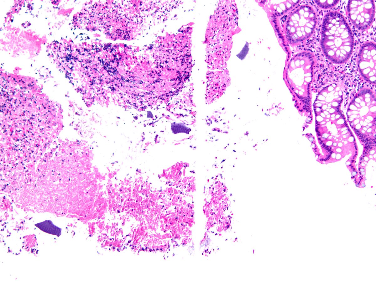 smlungpathguy tweet picture