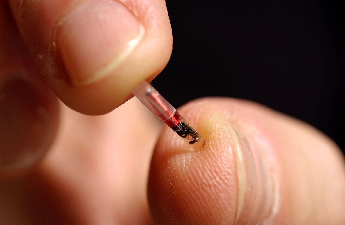 Recode's tweet photo. The next evolution in office working could be employees getting implanted with a microchip https://t.co/Xa33AbTYvL https://t.co/oB5fwXCq3k