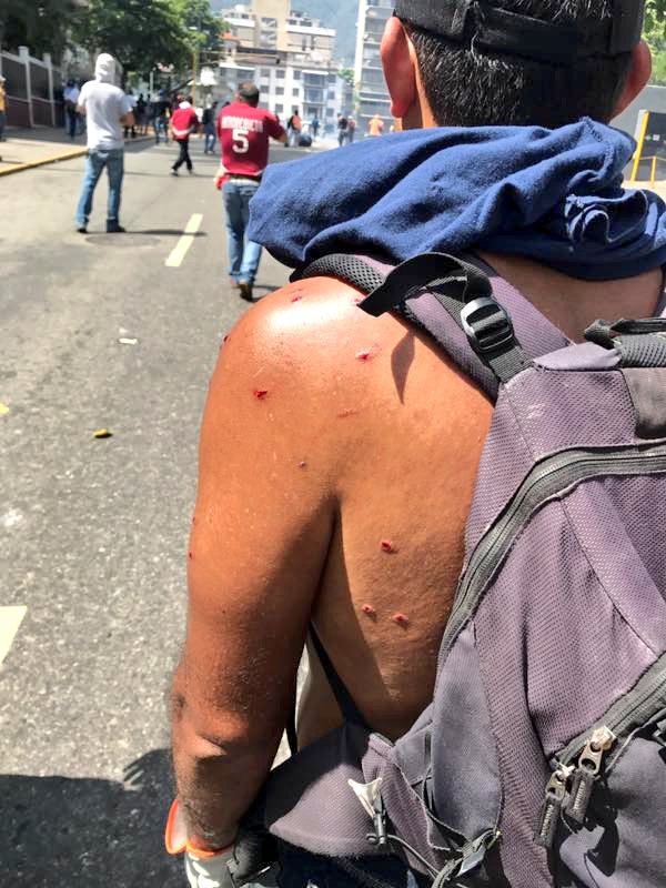 joseolivaresm's tweet photo. Además de gases lacrimógenos están disparando perdigones, ya hay algunos heridos!!!! #VzlaEnLuchaYResistencia https://t.co/AfcWCCYVT9