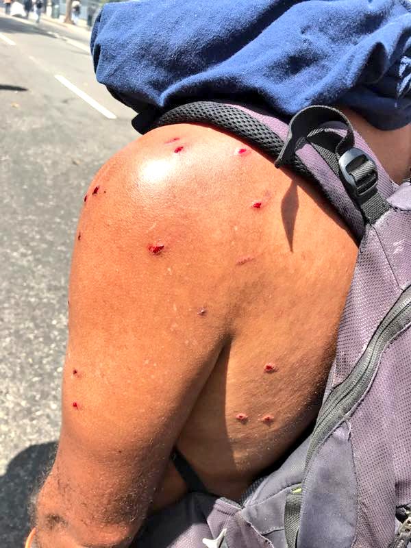 joseolivaresm's tweet photo. Además de gases lacrimógenos están disparando perdigones, ya hay algunos heridos!!!! #VzlaEnLuchaYResistencia https://t.co/AfcWCCYVT9