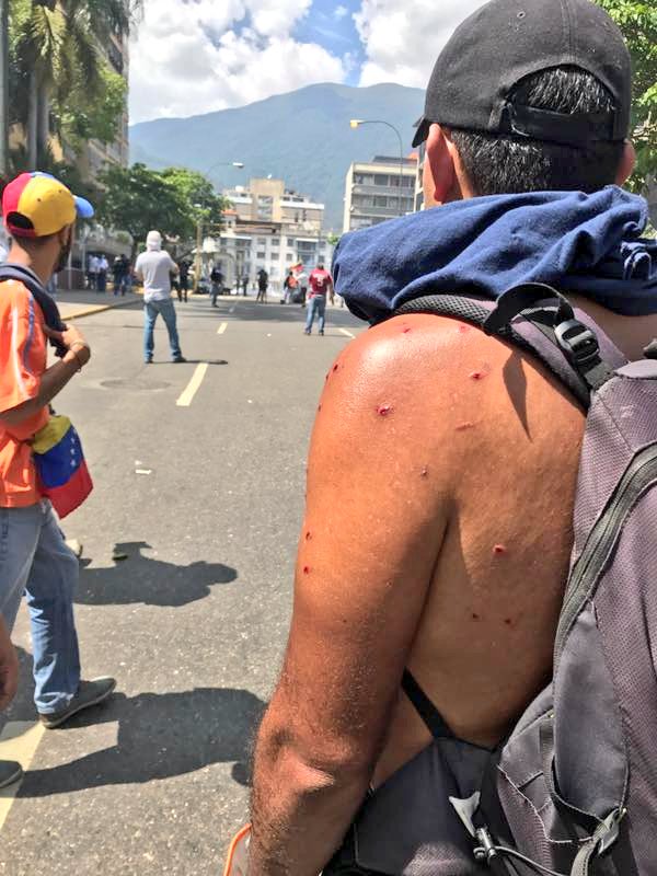 joseolivaresm's tweet photo. Además de gases lacrimógenos están disparando perdigones, ya hay algunos heridos!!!! #VzlaEnLuchaYResistencia https://t.co/AfcWCCYVT9