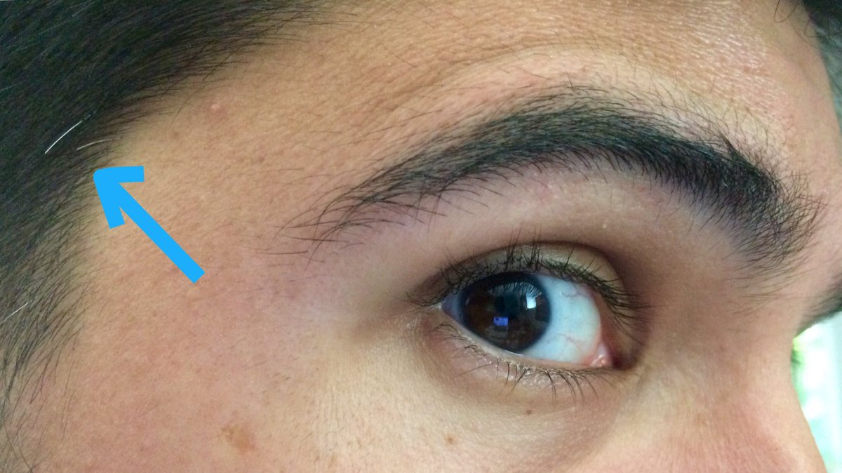 MikeVersus's tweet image. It has begun!
#abouttimeiguess
#nevergettingan18TLYpartnow
#signsofmaturity
#buyingatransformertoplacatemyself