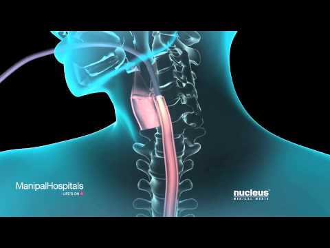 Okudunuz mu? Endoskopi nasil yapilir? dlvr.it/NrDfp7 #7saniye #Saglik #Video