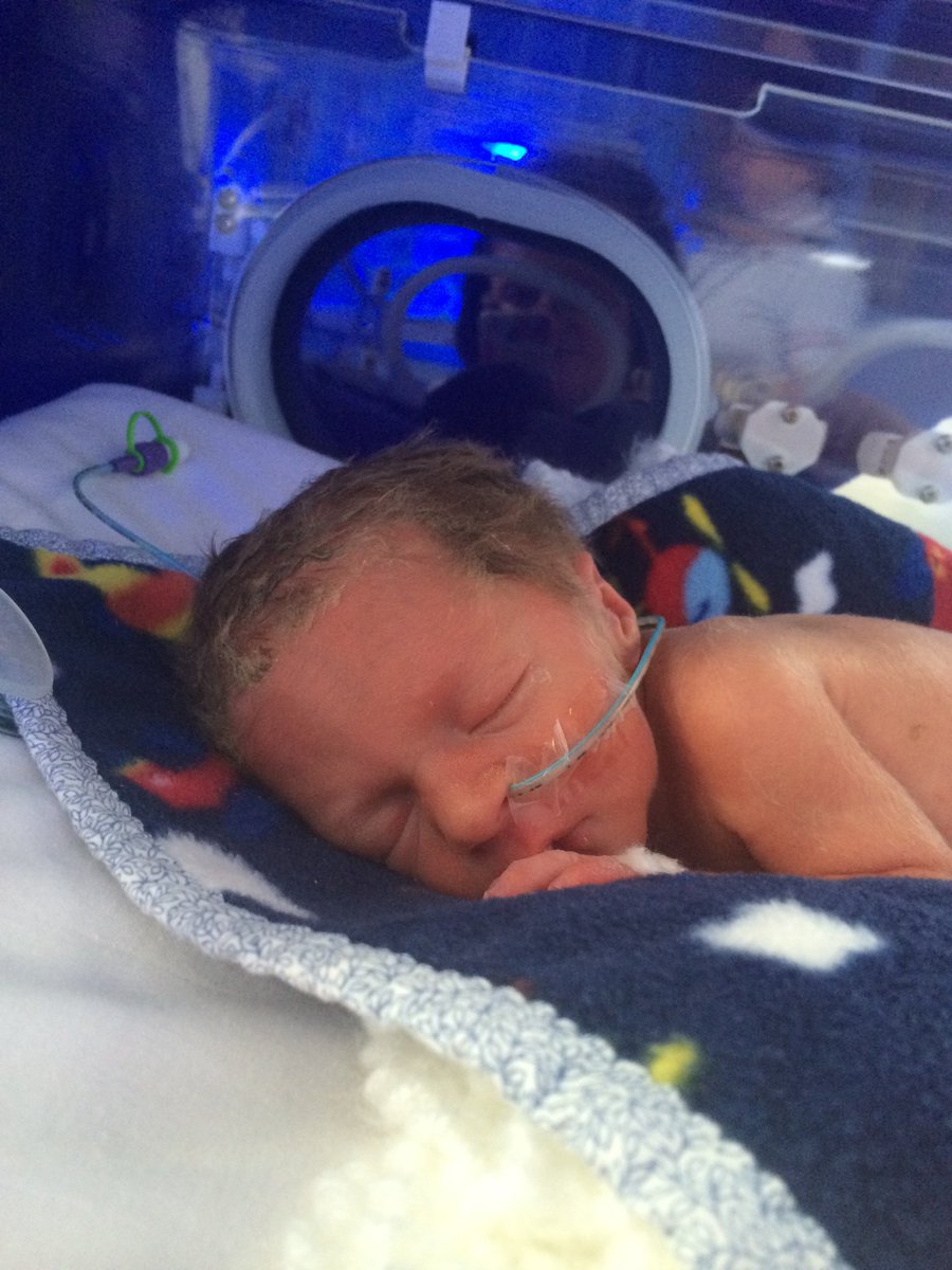 If you haven't already seen Henry and Seb's incredible story &amp; TTTS surgery footage, visit our you tube channel: youtube.com/user/twinsandm…