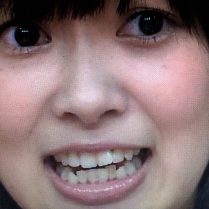 ガタガタの口内がこんなに綺麗に 歯並びを矯正した芸能人まとめ Miima ミーマ