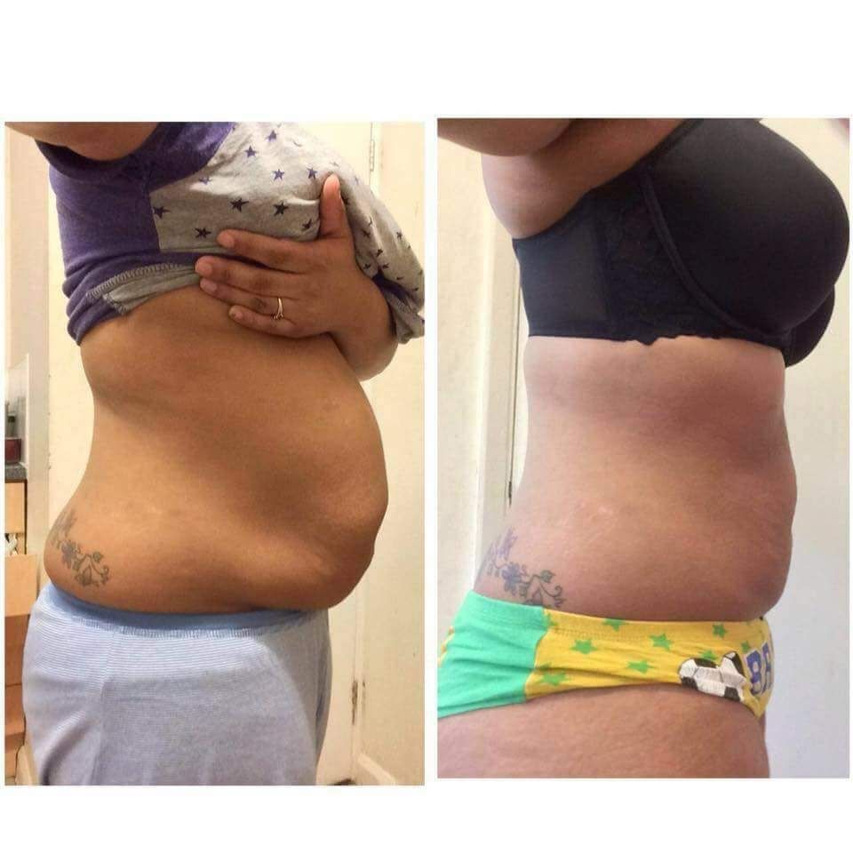 natasha_farrant's tweet image. Summer 😎 body 👙 well on it's way 👍 

Want to be body confident this summer? 

Drop me a message 💌 start today