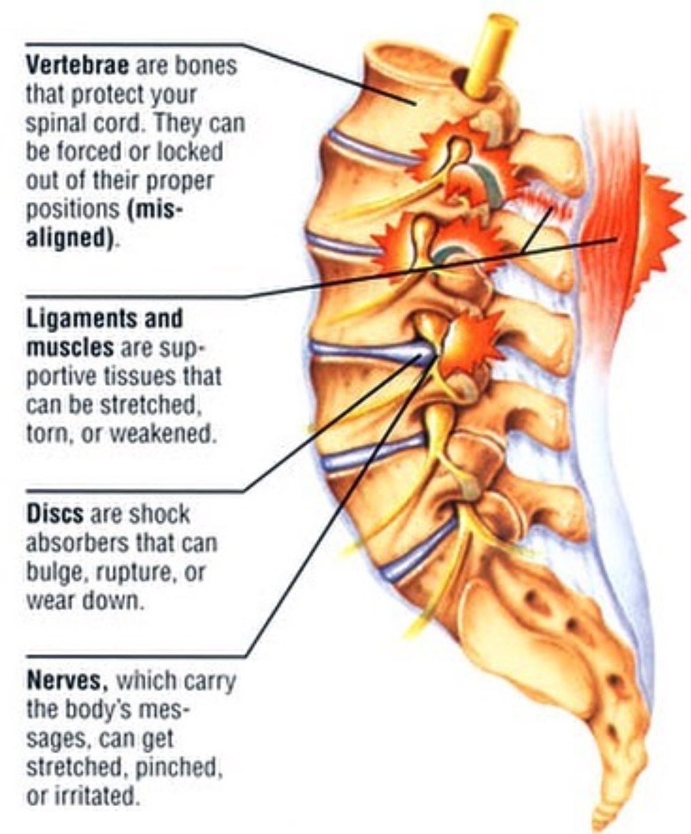 EliteCarePros's tweet photo. 4 reasons why you may either feel pain or some kind of discomfort. #chiropractic #getadjusted #alignment #spine #chiroworks https://t.co/FS8ywHVHt2